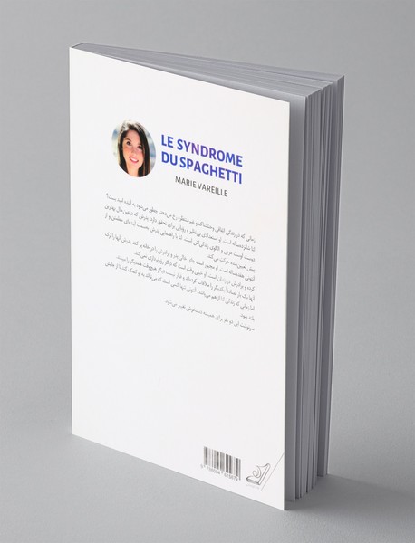 سندروم اسپاگتی