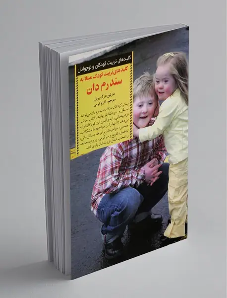 کلیدهای تربیت کودک مبتلا به سندرم دان